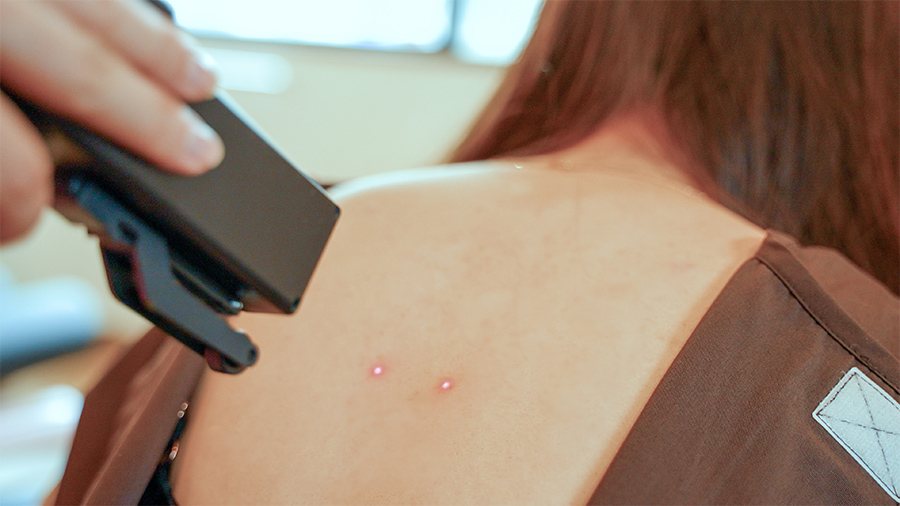 写真:背中に施術を行っている